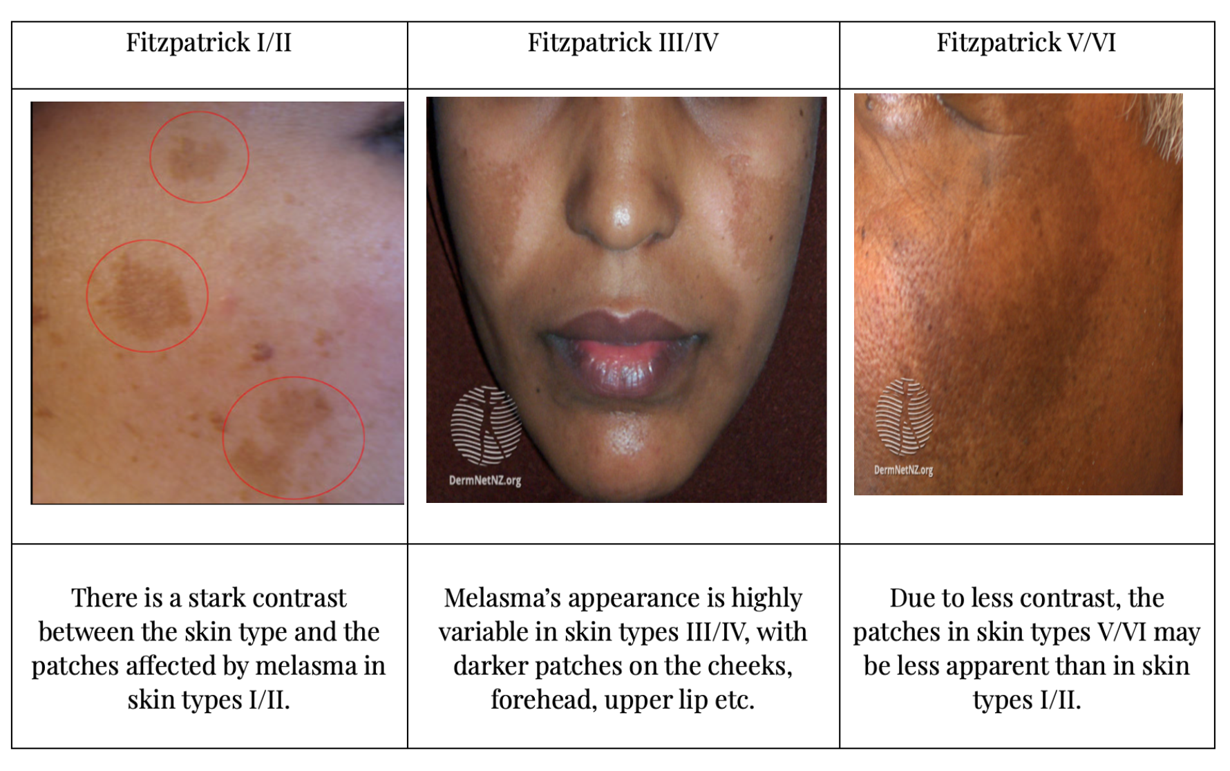 dusky skin color medical