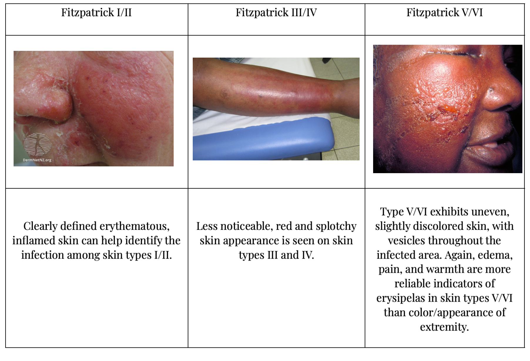 dusky skin color medical