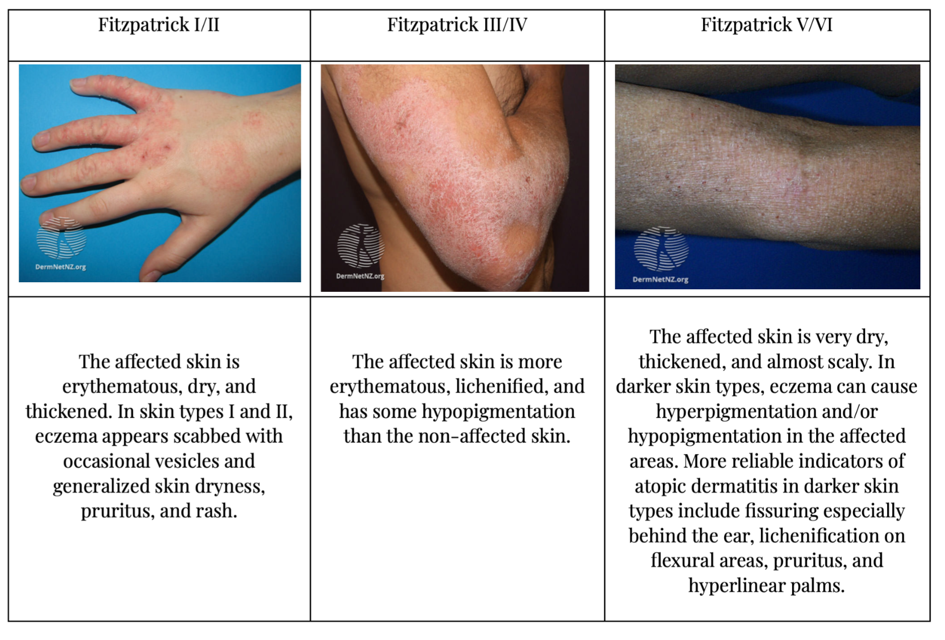 Derm Dx: Black discoloration of the hands - Clinical Advisor